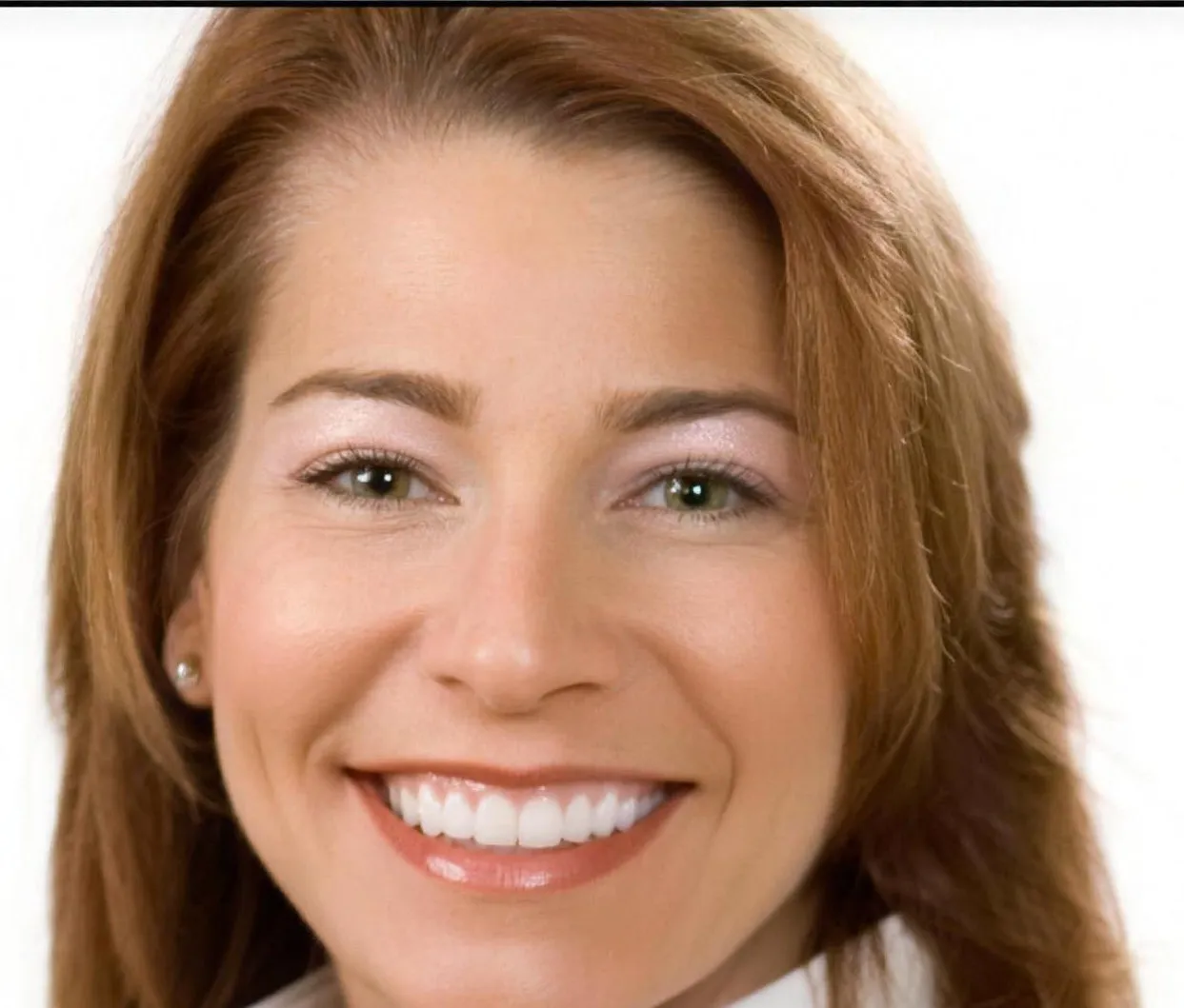 A patient of Sarasota Smile Design in Sarasota, Florida