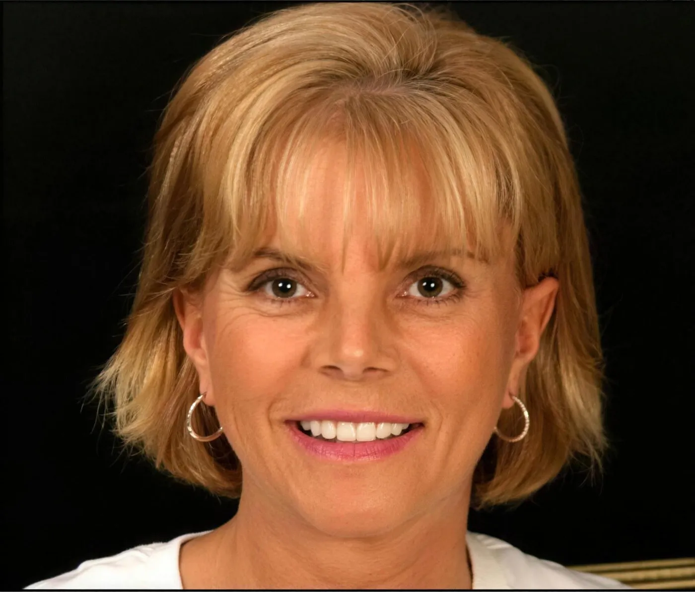 A patient of Sarasota Smile Design in Sarasota, Florida