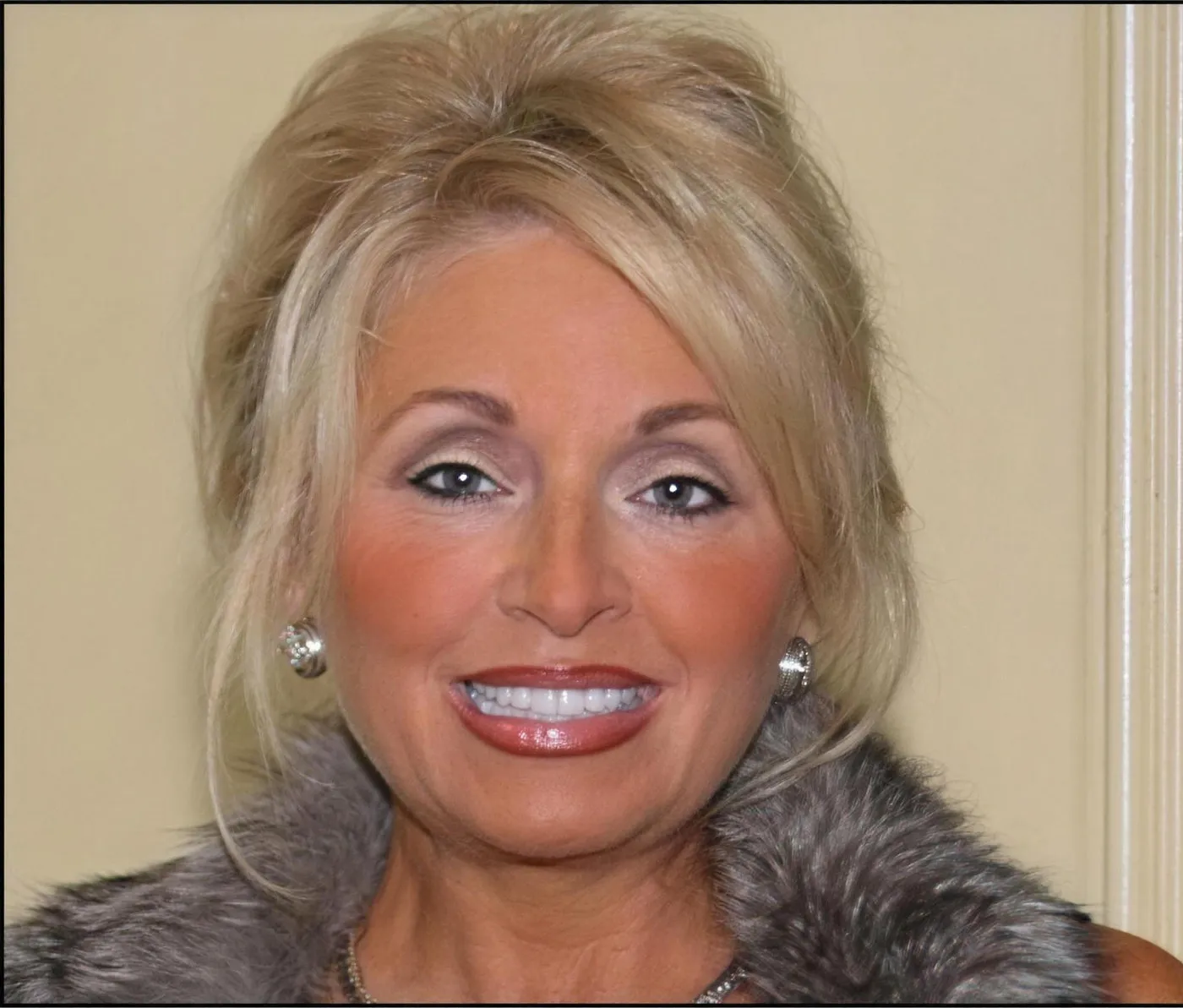 A patient of Sarasota Smile Design in Sarasota, Florida