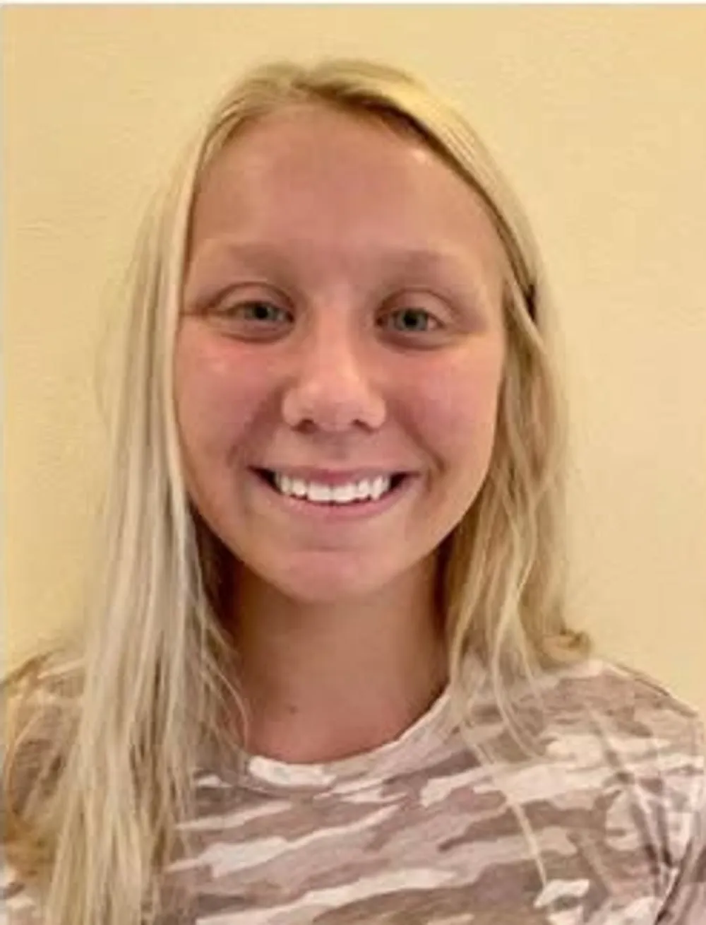 After treatment at Sarasota Smile Design in Sarasota, Florida
