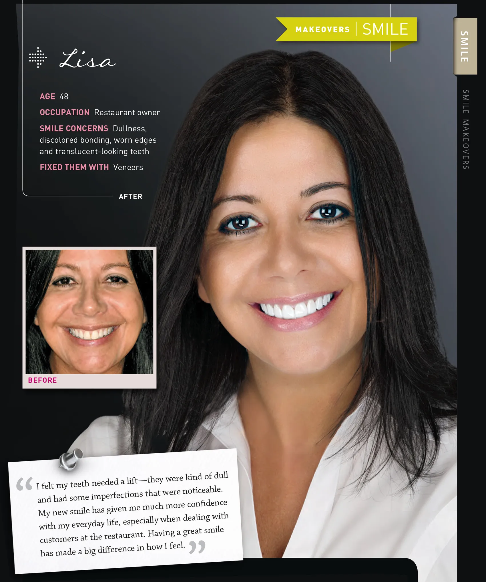 Lisa's case as printed in NewBeauty magazine, before and after, with the magazine's own case notes