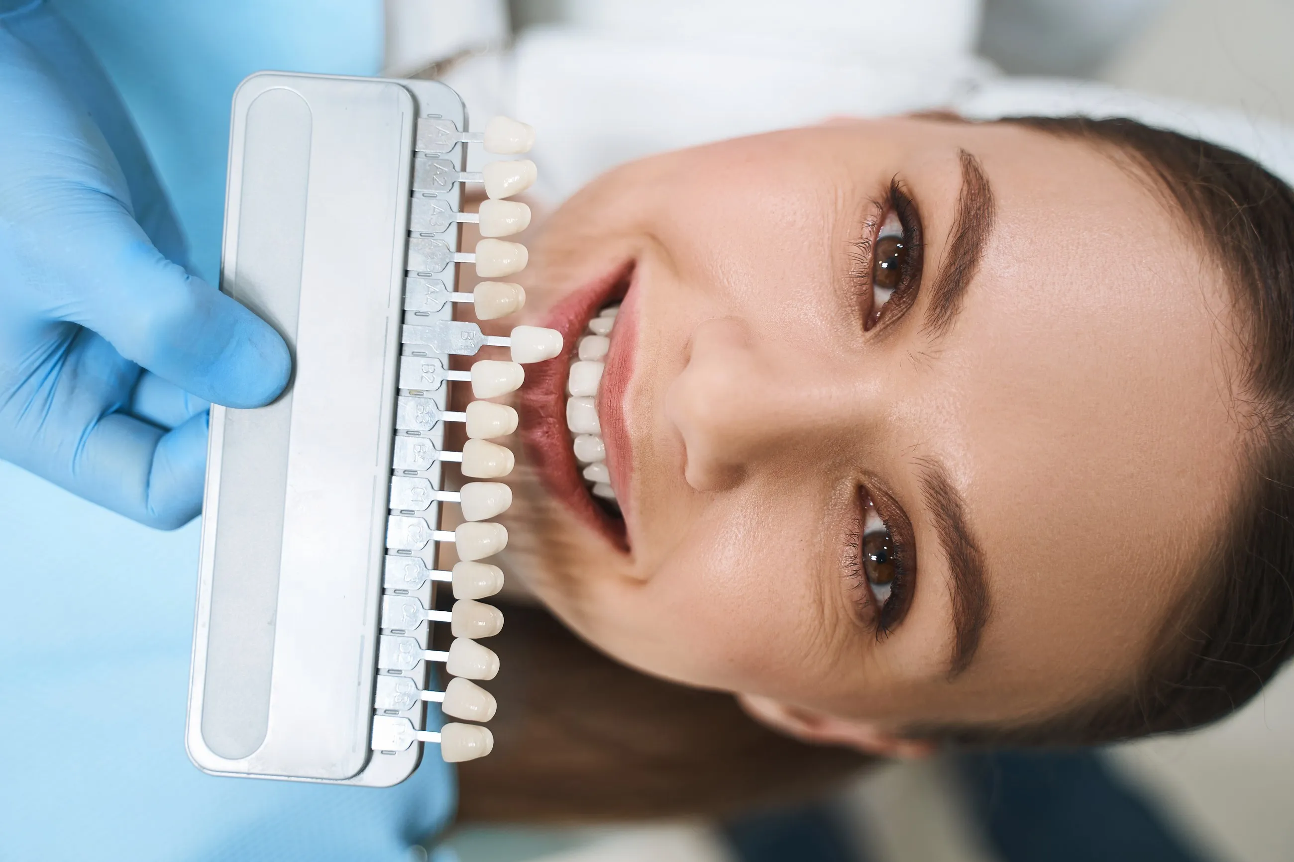 A woman smiling beside a tooth colour chart